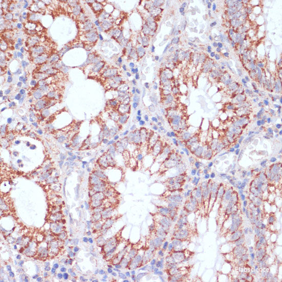 Immunohistochemistry of paraffin-embedded Human liver using ITGB3BP Polyclonal Antibody at dilution of 1:100 (40x lens).