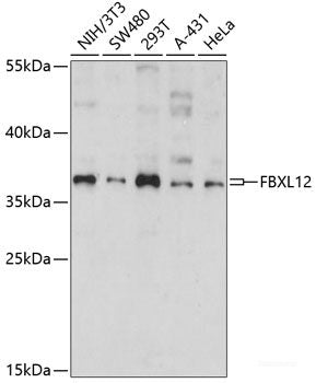 Immunohistochemistry of paraffin-embedded Human uterus using XBP1 Polyclonal Antibody at dilution of 1:100 (40x lens).