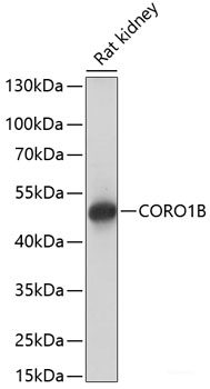 Immunohistochemistry of paraffin-embedded Rat liver using BRMS1 Polyclonal Antibody at dilution of 1:100 (40x lens).