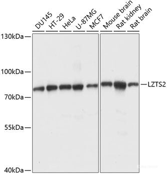 Western blot analysis of extracts of Mouse liver using ATRNL1 Polyclonal Antibody at dilution of 1:1000.
