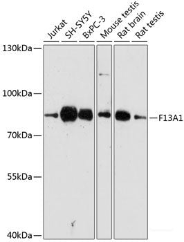 Western blot analysis of extracts of Mouse kidney using RPS6KA6 Polyclonal Antibody at dilution of 1:1000.