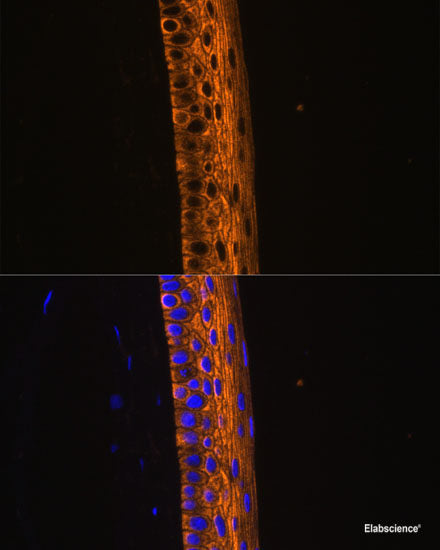 Western blot analysis of extracts from normal (control) and CHRAC1 knockout (KO) HeLa cells using CHRAC1 Polyclonal Antibody at dilution of 1:1000.