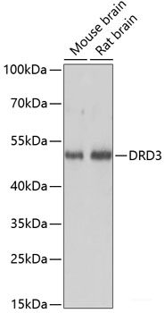 Immunohistochemistry of paraffin-embedded Human lung cancer using ZNF562 Polyclonal Antibody at dilution of 1:100 (40x lens).
