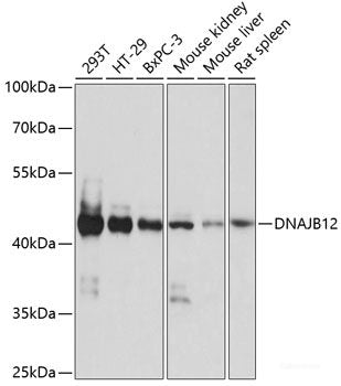 Western blot analysis of extracts of Rat spleen using BATF3 Polyclonal Antibody at dilution of 1:1000.