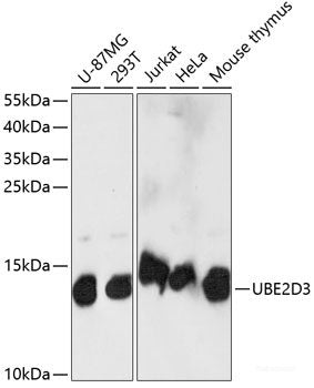 Immunofluorescence analysis of C6 cells using KLHL8 Polyclonal Antibody at dilution of 1:100. Blue: DAPI for nuclear staining.