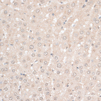 Immunohistochemistry of paraffin-embedded Human tonsil using ZNF574 Polyclonal Antibody at dilution of 1:100 (40x lens).