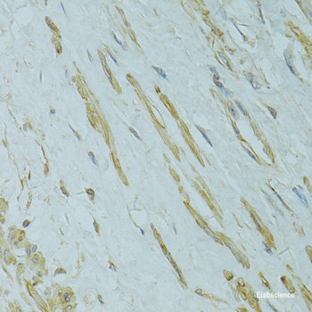 Immunohistochemistry of paraffin-embedded Rat testis using DDX59 Polyclonal Antibody at dilution of 1:100 (40x lens).