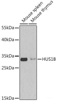 Immunohistochemistry of paraffin-embedded Human appendix using GLB1L3 Polyclonal Antibody at dilution of 1:150 (40x lens).