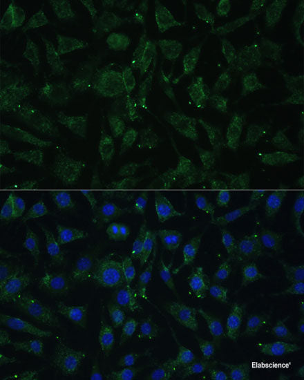 Western blot analysis of extracts of Rat stomach using B3GNT6 Polyclonal Antibody at dilution of 1:1000.