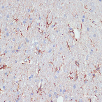 Western blot analysis of extracts of Human placenta using ZNF549 Polyclonal Antibody at dilution of 1:1000.