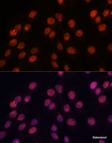 Western blot analysis of extracts of Rat testis using ZNF677 Polyclonal Antibody at dilution of 1:1000.