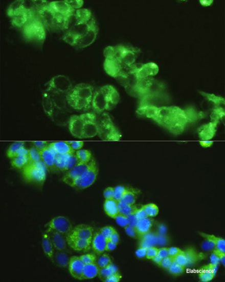 Western blot analysis of extracts of Mouse testis using CDK14 Polyclonal Antibody at dilution of 1:1000.