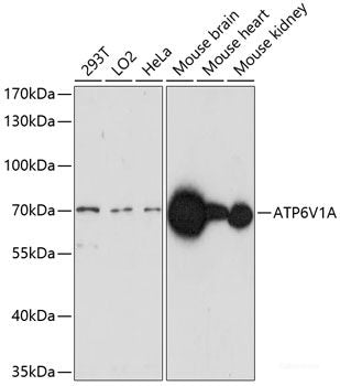 Immunofluorescence analysis of NIH/3T3 cells using KAT6A Polyclonal Antibody at dilution of 1:100. Blue: DAPI for nuclear staining.