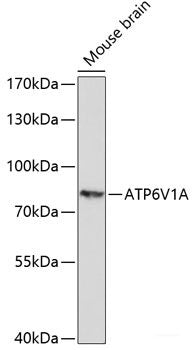 Immunofluorescence analysis of L929 cells using ACSS1 Polyclonal Antibody at dilution of 1:100. Blue: DAPI for nuclear staining.
