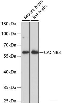 Western blot analysis of extracts of various cell lines using SEPT8 Polyclonal Antibody at dilution of 1:1000.