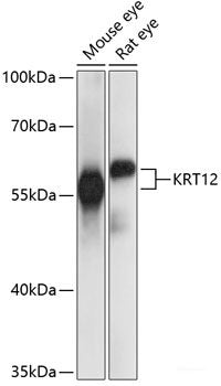 Immunofluorescence analysis of HeLa cells using SLC25A4 Polyclonal Antibody at dilution of 1:100 (40x lens). Blue: DAPI for nuclear staining.