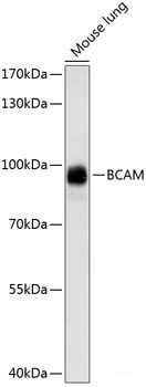 Immunofluorescence analysis of U2OS cells using SLC25A6 Polyclonal Antibody at dilution of 1:100. Blue: DAPI for nuclear staining.