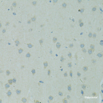 Immunofluorescence analysis of U2OS cells using ARSF Polyclonal Antibody at dilution of 1:100. Blue: DAPI for nuclear staining.