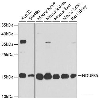 Immunofluorescence analysis of 293T cells using CCNA2 Polyclonal Antibody at dilution of 1:100 (40x lens). Blue: DAPI for nuclear staining.