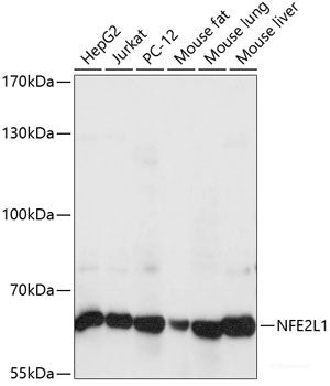 Immunohistochemistry of paraffin-embedded Human liver using CD68 Polyclonal Antibody at dilution of 1:200 (40x lens).