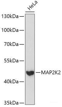Immunofluorescence analysis of HeLa cells using CYP2J2 Polyclonal Antibody at dilution of 1:100 (40x lens). Blue: DAPI for nuclear staining.