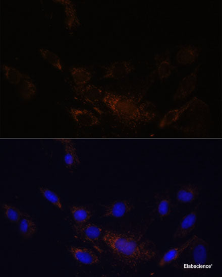 Immunofluorescence analysis of U2OS cells using CYP11B1 Polyclonal Antibody at dilution of 1:100. Blue: DAPI for nuclear staining.