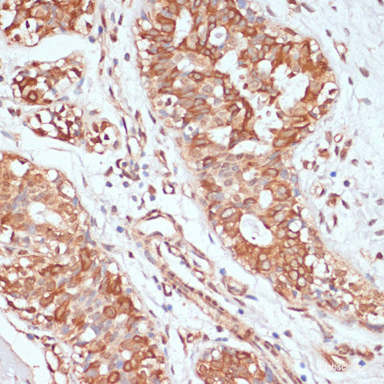 Immunofluorescence analysis of C6 cells using DCN Polyclonal Antibody at dilution of 1:100 (40x lens). Blue: DAPI for nuclear staining.