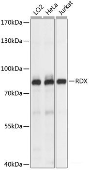 Immunohistochemistry of paraffin-embedded Human lung cancer using CTTN Polyclonal Antibody at dilution of 1:100 (40x lens).