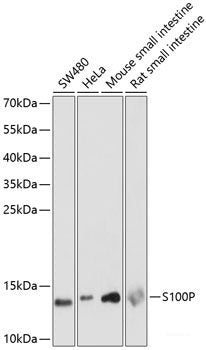 Immunofluorescence analysis of U2OS cells using GSTM3 Polyclonal Antibody at dilution of 1:100. Blue: DAPI for nuclear staining.