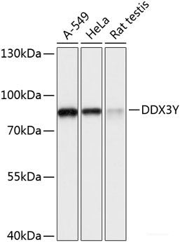 Immunohistochemistry of paraffin-embedded Rat lung using ITGAX Polyclonal Antibody at dilution of 1:100 (40x lens).