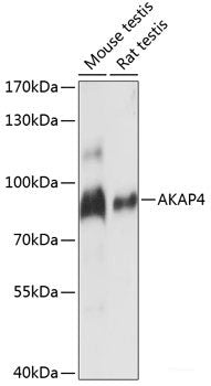 Immunofluorescence analysis of U2OS cells using PFKL Polyclonal Antibody at dilution of 1:100. Blue: DAPI for nuclear staining.