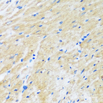Immunohistochemistry of paraffin-embedded Mouse retina using RHO Polyclonal Antibody at dilution of 1:200 (40x lens).