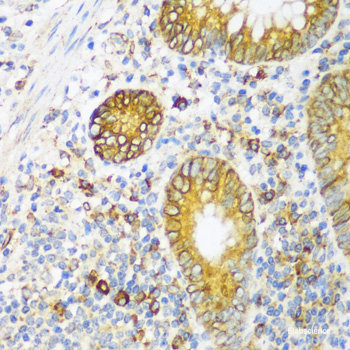 Immunohistochemistry of paraffin-embedded Rat bone marrow using TGFB1 Polyclonal Antibody at dilution of 1:100 (40x lens).