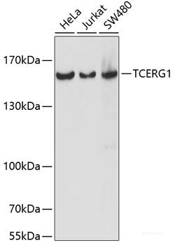 Immunofluorescence analysis of U2OS cells using TRAF3 Polyclonal Antibody at dilution of 1:100. Blue: DAPI for nuclear staining.