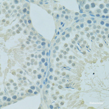 Immunofluorescence analysis of HeLa cells using TRPC6 Polyclonal Antibody at dilution of 1:100 (40x lens). Blue: DAPI for nuclear staining.