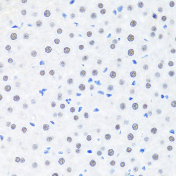 Immunofluorescence analysis of HeLa cells using CXCR4 Polyclonal Antibody at dilution of 1:100 (40x lens). Blue: DAPI for nuclear staining.