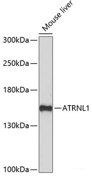 Immunofluorescence analysis of U2OS cells using FZD4 Polyclonal Antibody at dilution of 1:100. Blue: DAPI for nuclear staining.