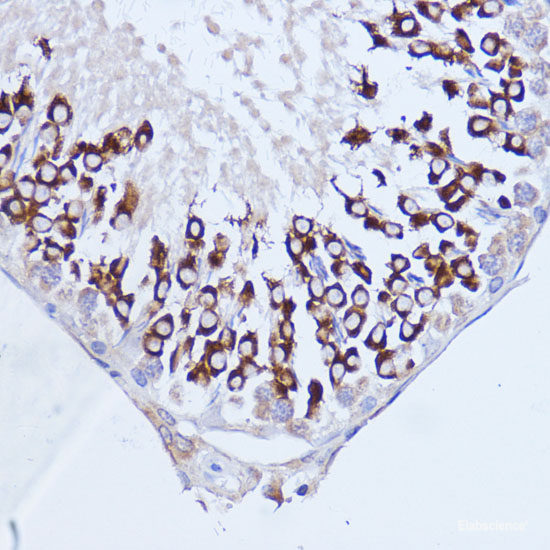 Immunohistochemistry of paraffin-embedded Rat spleen using CDC23 Polyclonal Antibody at dilution of 1:100 (40x lens).