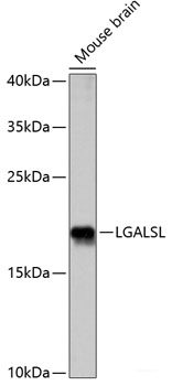 Western blot analysis of extracts of HeLa cells using RASAL2 Polyclonal Antibody at dilution of 1:1000.