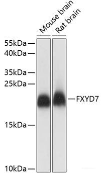 Western blot analysis of extracts of various cell lines using EIF5B Polyclonal Antibody.