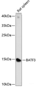 Western blot analysis of extracts of HeLa cells using RTN3 Polyclonal Antibody at dilution of 1:1000.