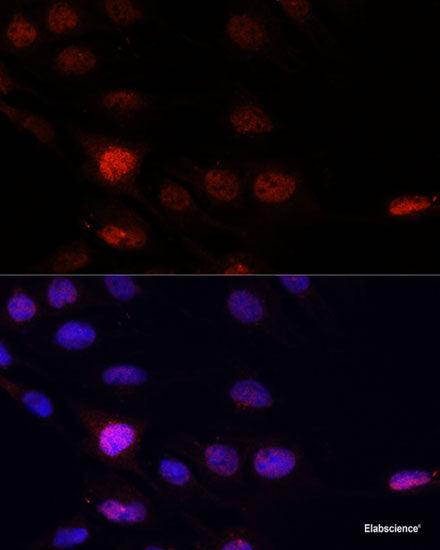 Immunofluorescence analysis of U2OS cells using MAP4K5 Polyclonal Antibody at dilution of 1:100. Blue: DAPI for nuclear staining.