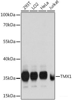 Western blot analysis of extracts of various cell lines using CLDN17 Polyclonal Antibody at dilution of 1:1000.