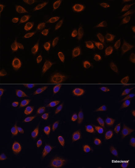 Western blot analysis of extracts of Raji cells using FLVCR1 Polyclonal Antibody at dilution of 1:1000.