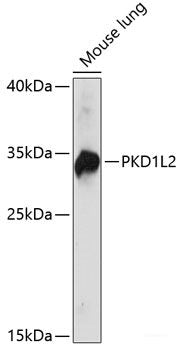 Western blot analysis of extracts of various cell lines using VPS36 Polyclonal Antibody at dilution of 1:3000.
