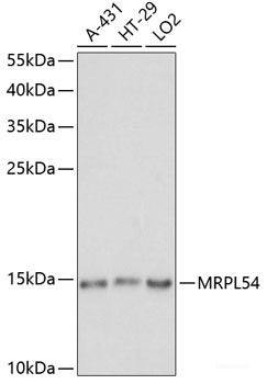 Western blot analysis of extracts of Mouse kidney using HAO2 Polyclonal Antibody at dilution of 1:1000.