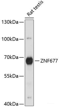 Western blot analysis of extracts of various cell lines using IGF2BP1 Polyclonal Antibody at dilution of 1:1000.