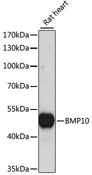 Western blot analysis of extracts of various cell lines using PICK1 Polyclonal Antibody at dilution of 1:1000.