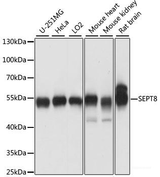 Immunofluorescence analysis of Hela cells using ZNF408 Polyclonal Antibody at dilution of 1:100 (40x lens). Blue: DAPI for nuclear staining.