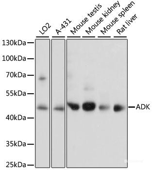 Immunofluorescence analysis of U2OS cells using ALG2 Polyclonal Antibody at dilution of 1:100. Blue: DAPI for nuclear staining.